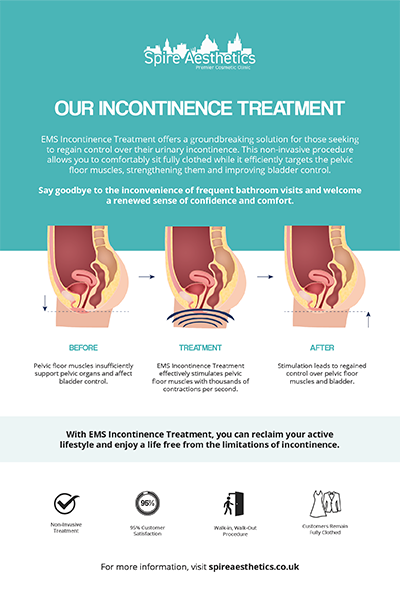 image to show how EMS treatment works for female urinary incontinence Gilmerton