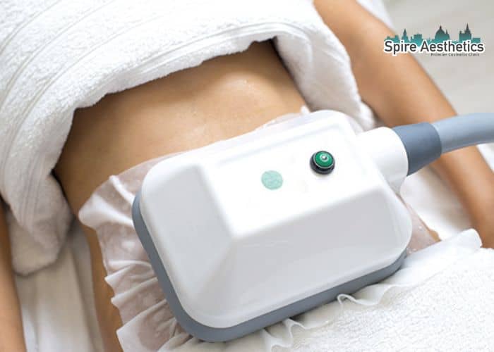 Shift Those Extra Pounds: How Fat Freezing Can Help You Slim Down Gilmerton